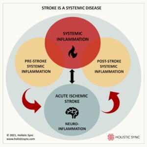 The relationship between pre- and post-inflammation and stroke